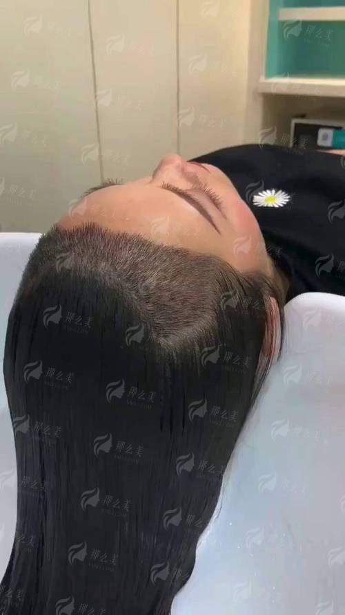 四、如何预约桂林华美的发际线种植服务?