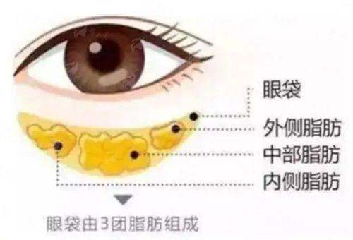 四、如何理性选择并预约江西景德镇华瑞医疗的眼袋治疗？