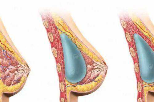 三、上海佳太美医疗美容的产后修复有什么优势？