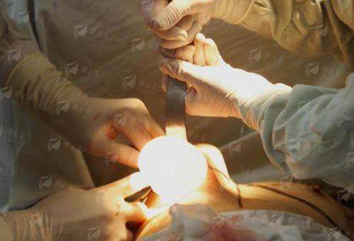 四、如何选择与决策？给美亲的更终建议