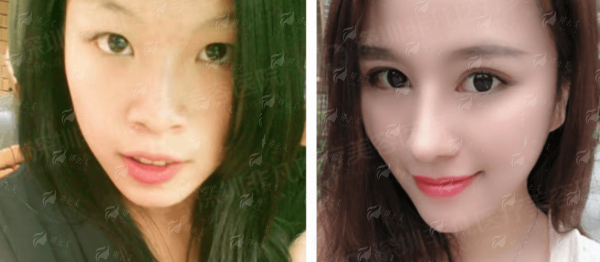 一、深圳非凡医疗美容医院：专精医美机构保护手术安心