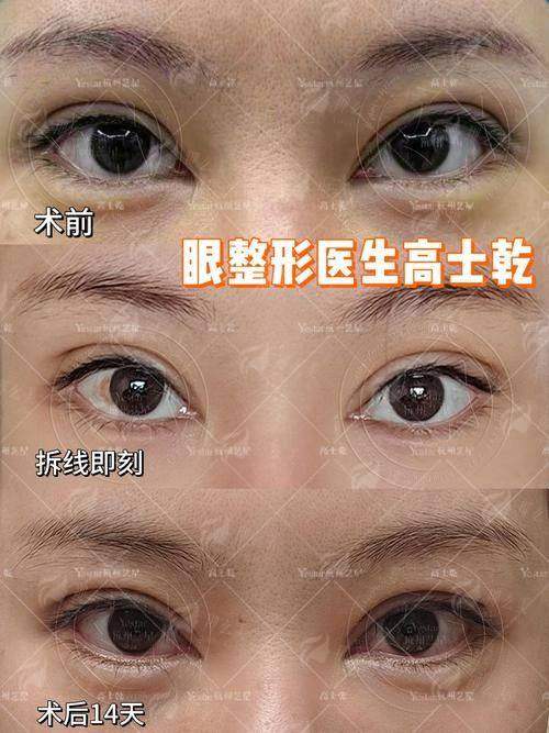 四、如何预约石家庄天宏医疗美容医院的闫国剑医生做眼修复？