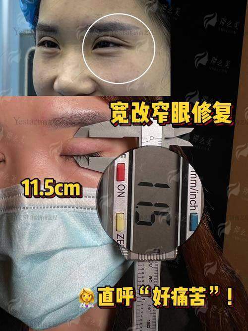 三、除了石家庄天宏医疗美容医院，石家庄还有哪些眼修复选择？