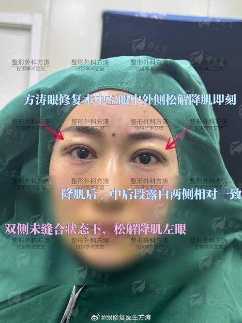 二、石家庄天宏医疗美容医院的闫国剑医生眼修复价格贵不贵？