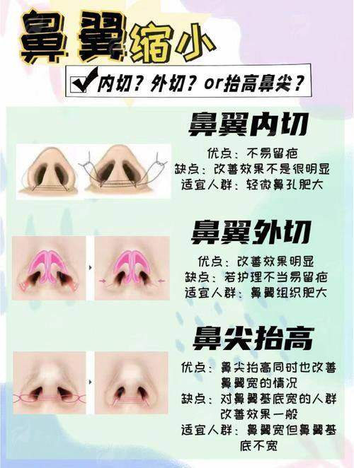 一、北京宫国华医美的鼻翼缩小，到底厉害在哪里？