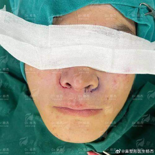 二、想预约宫国华医生做鼻翼缩小，有哪些方式？