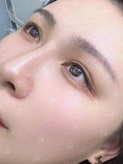 四、如何预约绵阳宜宾丝缘植发的睫毛种植服务？