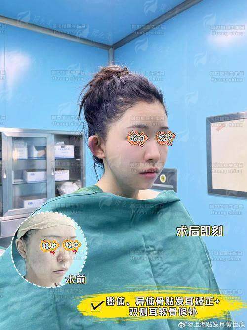 四、关于“精灵耳”与陈星帆医生的总结与贴心建议