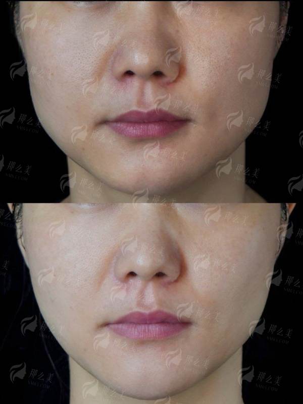 六、透明价格体系：性价比之选