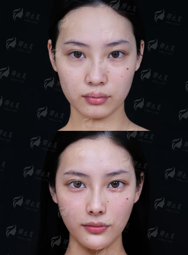 上海美辰美医疗美容门诊部到底怎么样？实测口碑+坐诊医生全解析！新颜智尚一键查询，预约电话&口碑评价速看