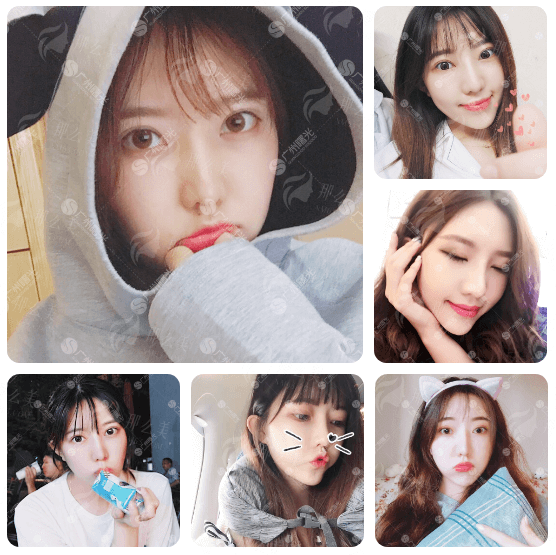 三、选择广州曙光彭双英医生激光祛斑，价格和服务怎么样？