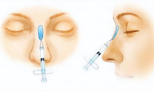 <strong>二、医生解析：王永平与朱迪，谁更能成就您的自然双眸？</strong>