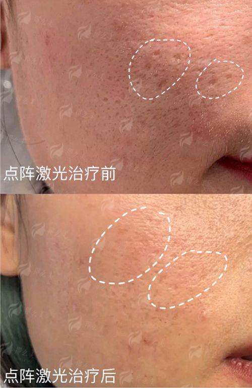 <strong>三、口碑与实例参考：真实反馈见证成效</strong>