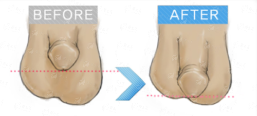 深圳找靠谱医美怕踩坑？速看米兰柏羽医院医生坐诊详情与真实案例，新颜智尚一键查询官方入口，24小时在线预约
