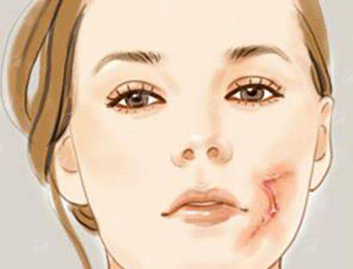 <strong>四、全渠道预约指南：便捷触达，一步到位</strong>