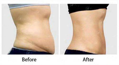 <strong>二、项目核心:医生技术与特色方案的结合</strong>