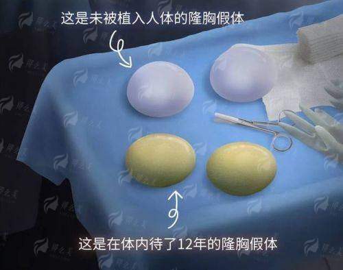 二、汕头汕美整形的隆胸医生团队靠谱吗？