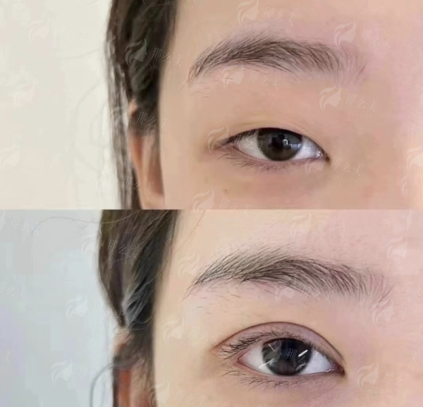 <strong>二、 核心解析：刘菲菲医生与项目技术深度解读</strong>