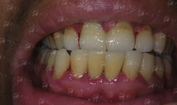 <strong>二、核心项目与骨干医生团队优势解析</strong>