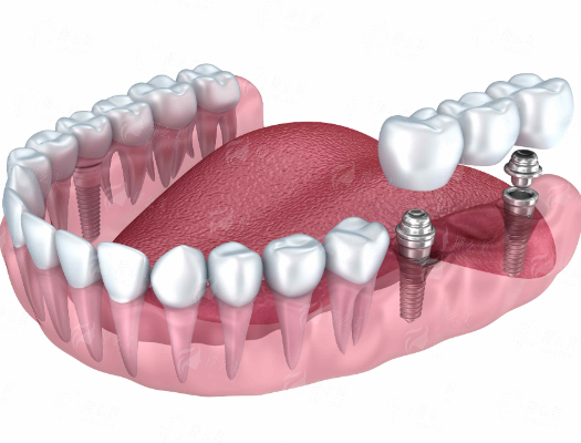 <strong>三、真实实例与患者口碑参考</strong>