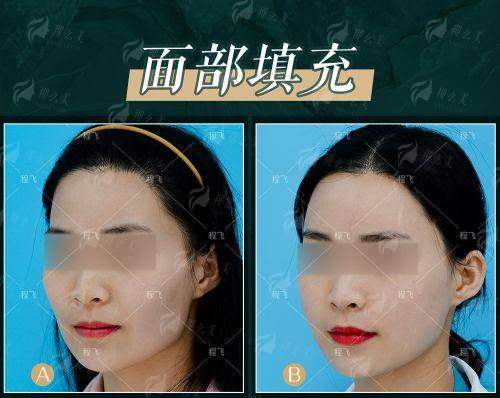 三、理性对比：广州地区隆胸选择与郭震宇隆胸的定位