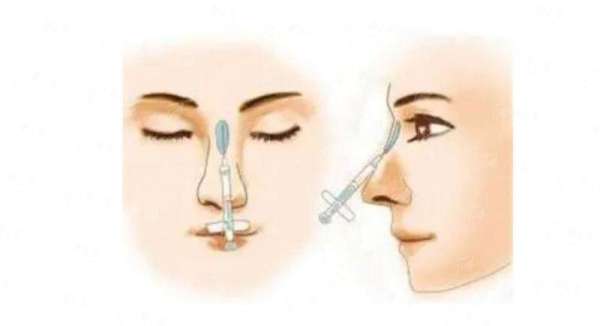 四、安心之选：与广州高尚整形医院郭震宇团队沟通的注意事项