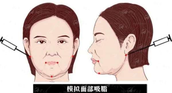 一、深入解析：广州高尚整形医院的郭震宇隆胸技术特色