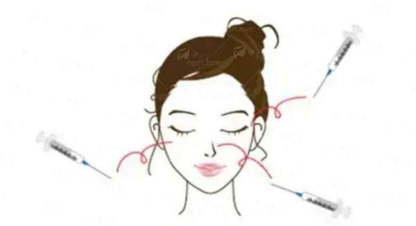 二、全方面了解：选择广州高尚整形医院郭震宇隆胸的预约与流程