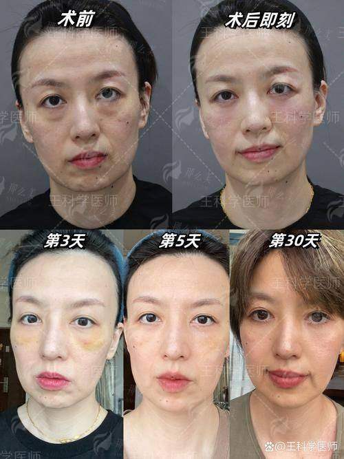 想了解景德镇华瑞去眼袋价格优惠攻略？新颜智尚小程序预约，附真实用户反馈