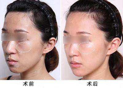 <strong>四、便捷预约：全渠道操作指南与关键提醒</strong>