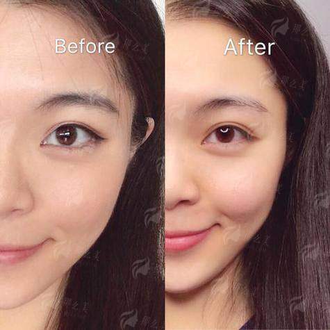 <strong>二、核心优势：医生技术与项目特色的深度解析</strong>