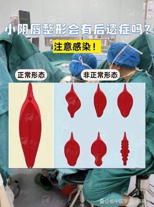 三、在兰州维多丽亚整形做私密整形，价格和流程是怎样的？