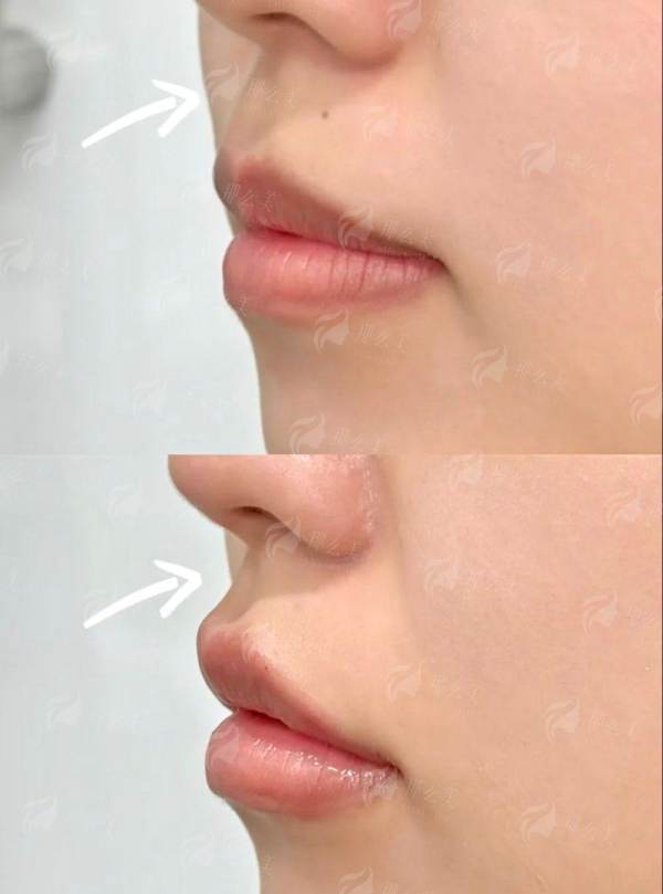 <strong>四、清晰指引：全渠道预约步骤详解</strong>