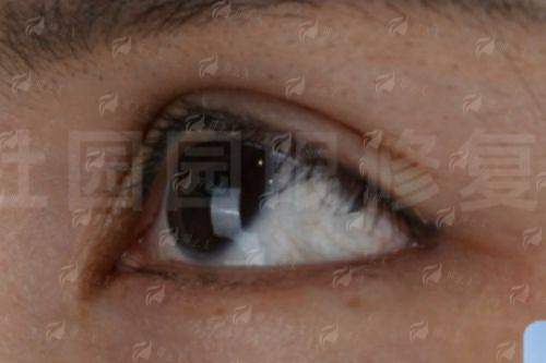 <strong>三、成效参考：真实实例与口碑印证</strong>