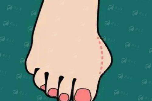 <strong>五、费用参考：透明了解，理性选择</strong>