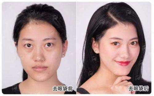 <strong>三、俞冰医生特色项目及价格参考</strong>