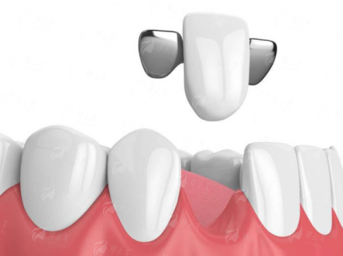 揭秘绵阳中绵口腔医院！种植牙价格、医生团队全解析，新颜智尚小程序预约快人一步