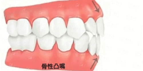 沈阳市第一人民医院口腔科怎么样？深扒技术/口碑/坐诊详情，预约难？新颜智尚一键查询，预约电话&口碑评价速看