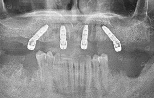 <strong>五、治疗项目价格参考</strong>