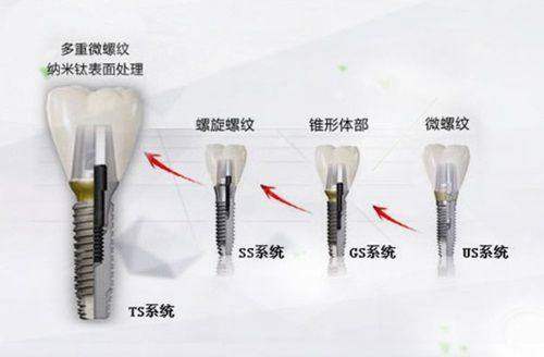 北京固瑞口腔门诊部预约总排队？异地患者必看！官方预约通道&内部快捷方式揭秘，新颜智尚小程序查找指南，预约流程全解析