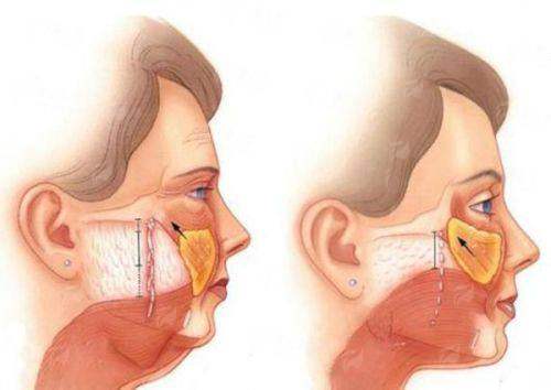 <strong>六、预约俞冰医生的注意事项</strong>