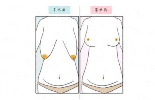 三、刘城宏医生核心医美项目详解