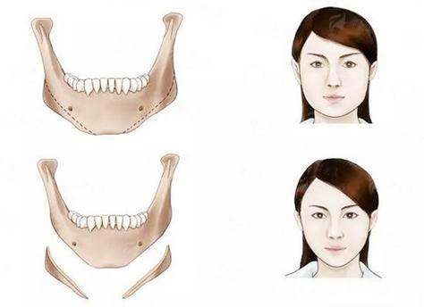 <strong>六、成都八大处医疗美容医院术后护理服务</strong>