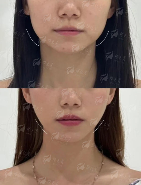 纠结无锡医美哪家好？聚焦曜颜医疗颜曦焕院区，技术/效果/价格档位全测评！新颜智尚一键预约防踩坑，领取内部折扣