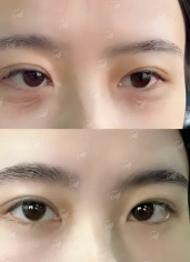 重庆米兰柏羽时光整形医院怎么样？热门价格参考！新颜智尚一键预约省心快速，预约电话&口碑评价速看