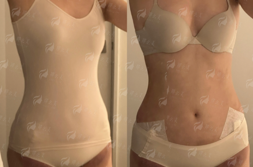 成都八大处马晓阳做双眼皮靠谱吗？坐诊地址在哪？附24小时预约通道