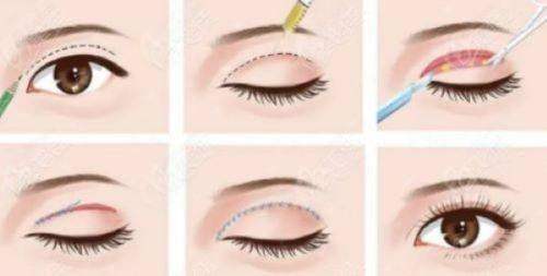 四、湖北恩施天后整形医院如何选择与预约？