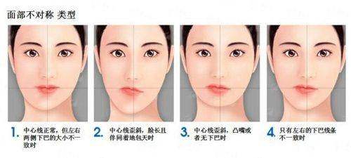 三、大连大学附属中山医院整形美容科实例参考:真实蜕变与专精口碑