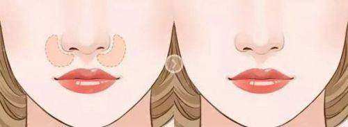 四、大连大学附属中山医院整形美容科便捷预约:多渠道指引与关键事项提醒