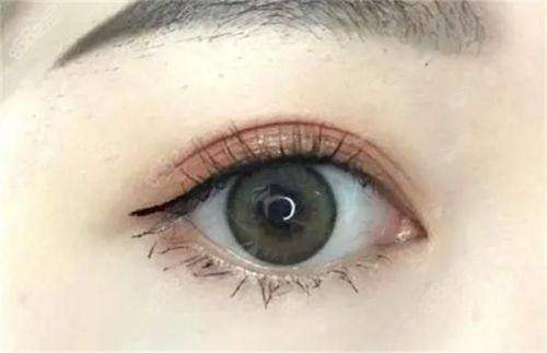 北京嘉禾做双眼皮哪个医生好？新颜智尚小程序可约，看真实案例与用户反馈分享